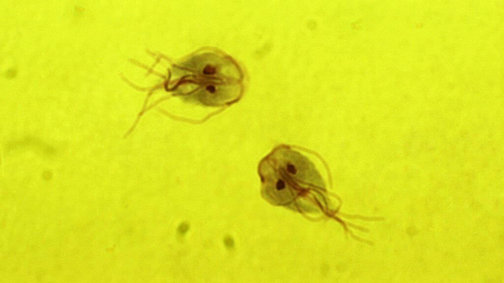 Giardia caused by beavers.